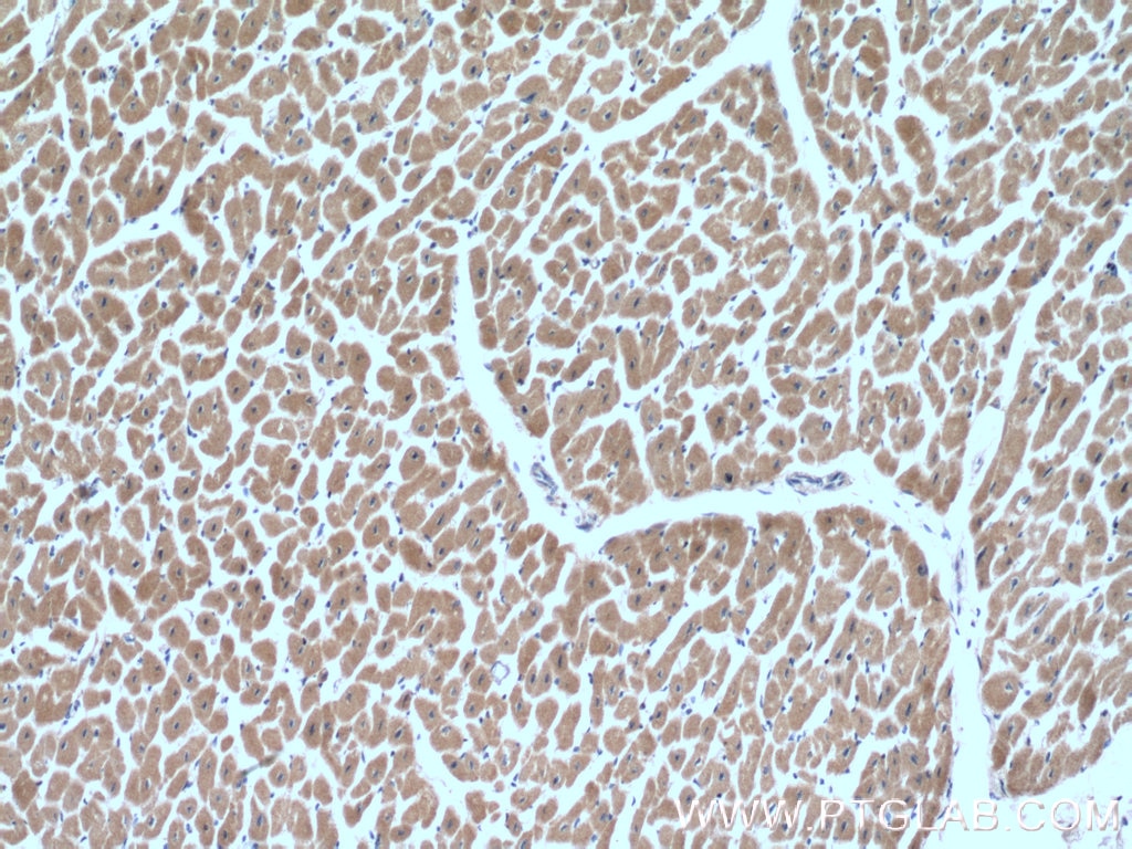 IHC staining of human heart using 10907-1-AP