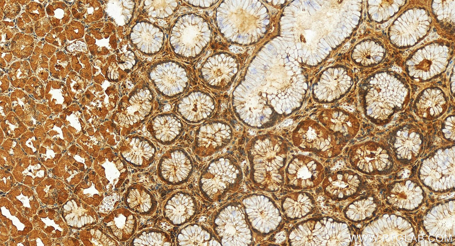 Immunohistochemistry (IHC) staining of human stomach tissue using Frataxin Polyclonal antibody (14147-1-AP)