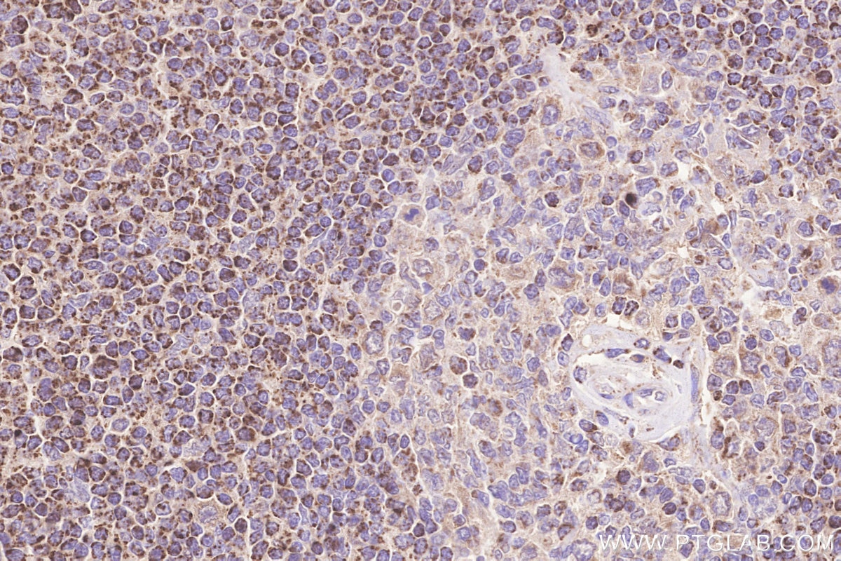 Immunohistochemistry (IHC) staining of human spleen tissue using Frataxin Polyclonal antibody (14147-1-AP)