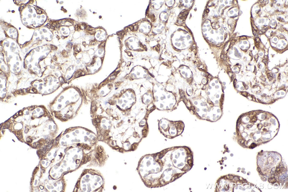 Immunohistochemistry (IHC) staining of human placenta tissue using FXR1 Polyclonal antibody (13194-1-AP)