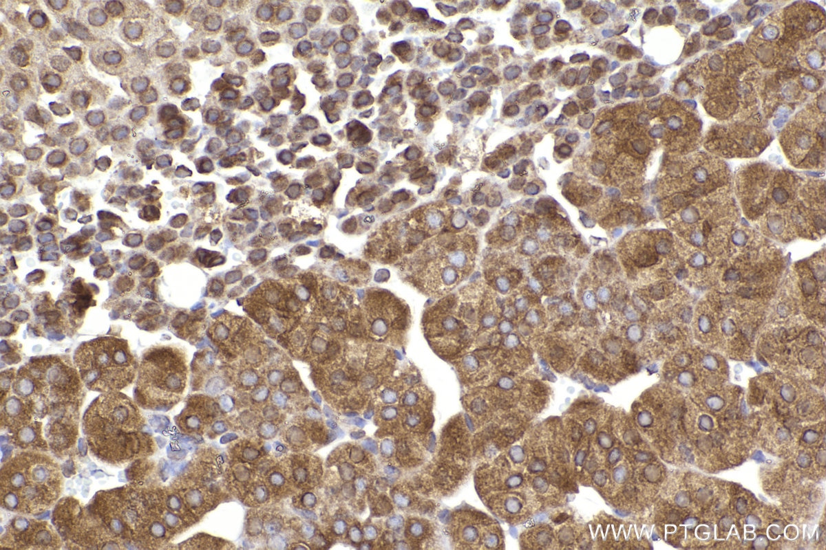 Immunohistochemistry (IHC) staining of mouse adrenal gland tissue using FXR1 Polyclonal antibody (13194-1-AP)