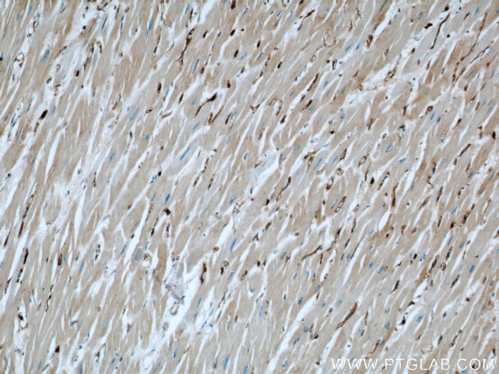 Immunohistochemistry (IHC) staining of human heart tissue using FXR1 Polyclonal antibody (13194-1-AP)