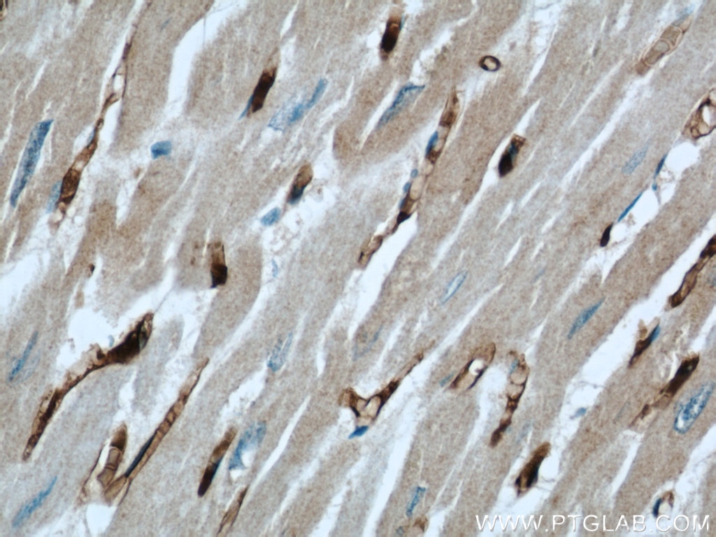 Immunohistochemistry (IHC) staining of human heart tissue using FXR1 Polyclonal antibody (13194-1-AP)