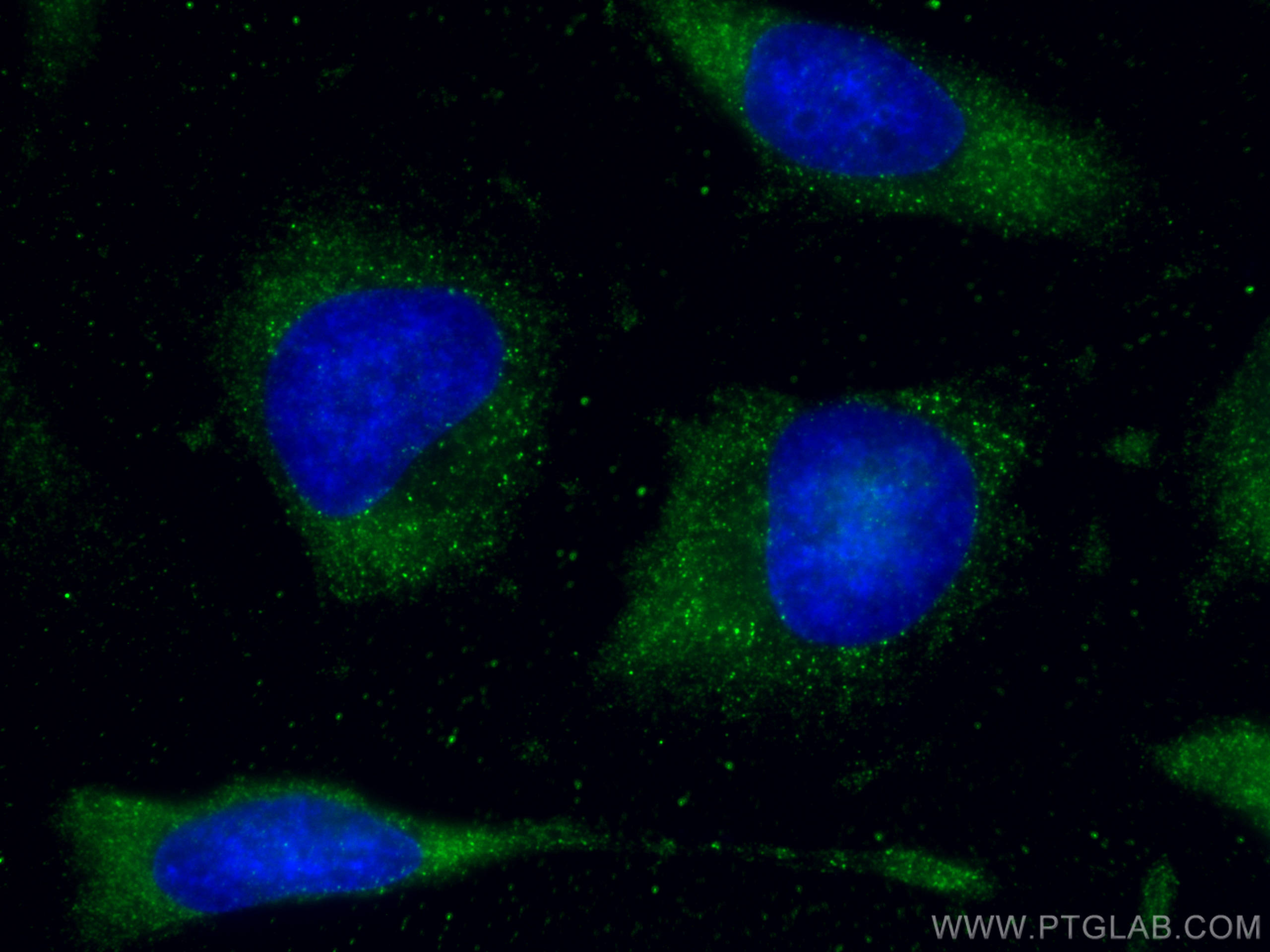 Immunofluorescence (IF) / fluorescent staining of HeLa cells using FXR1 Monoclonal antibody (67813-1-Ig)