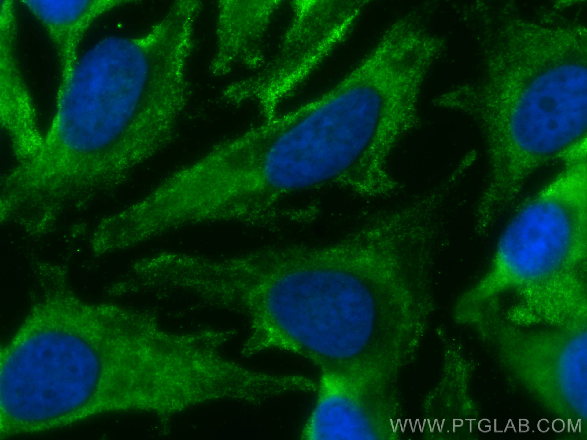 Immunofluorescence (IF) / fluorescent staining of HeLa cells using CoraLite® Plus 488-conjugated FXR1 Monoclonal anti (CL488-67813)