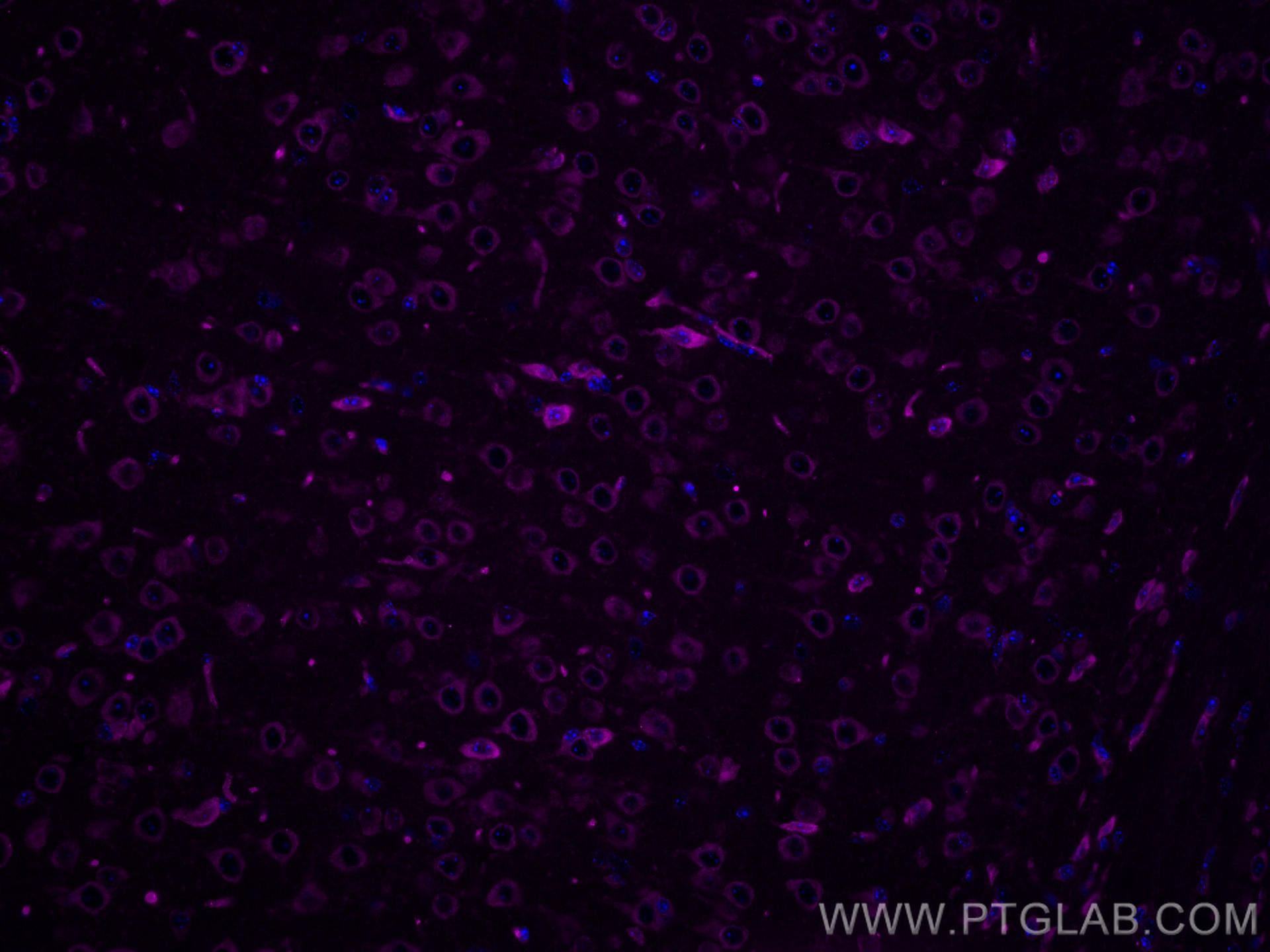 Immunofluorescence (IF) / fluorescent staining of mouse brain tissue using CoraLite® Plus 647-conjugated FXR1 Monoclonal anti (CL647-67813)