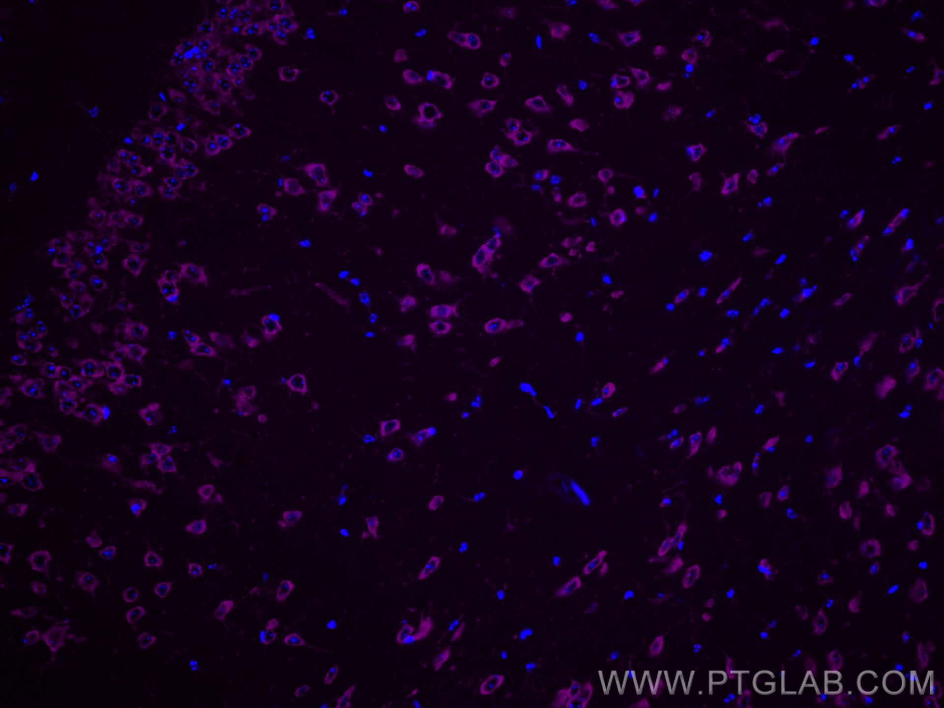Immunofluorescence (IF) / fluorescent staining of mouse brain tissue using CoraLite® Plus 647-conjugated FXR1 Monoclonal anti (CL647-67813)