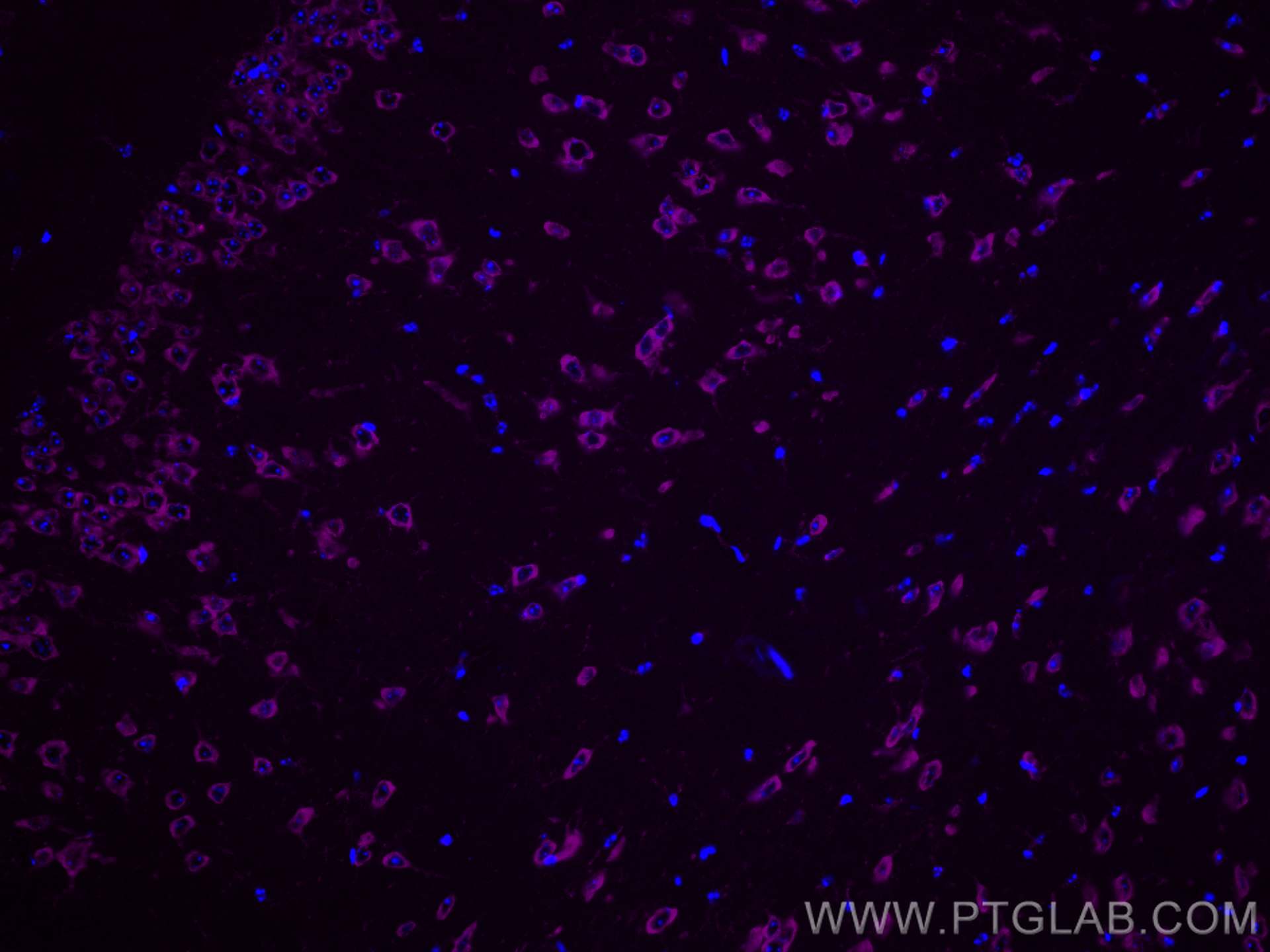 Immunofluorescence (IF) / fluorescent staining of mouse brain tissue using CoraLite® Plus 647-conjugated FXR1 Monoclonal anti (CL647-67813)