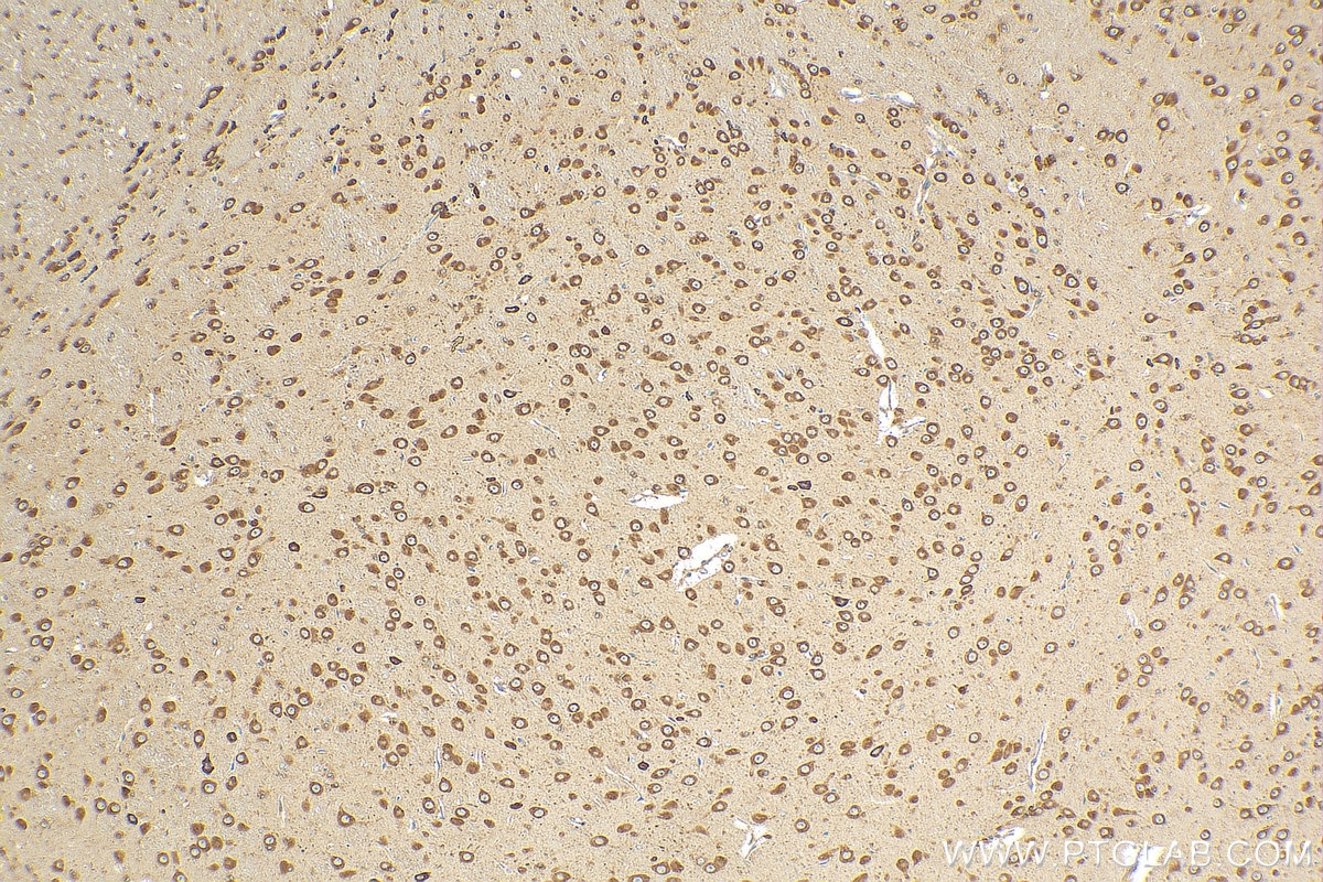 Immunohistochemistry (IHC) staining of mouse brain tissue using FXR2 Polyclonal antibody (12552-1-AP)