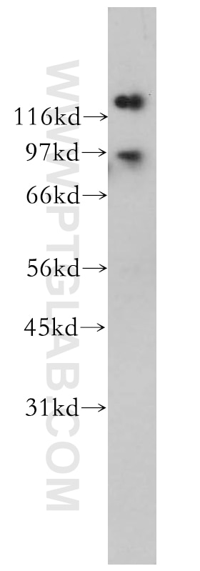 Western Blot (WB) analysis of human brain tissue using FXR2 Polyclonal antibody (12552-1-AP)