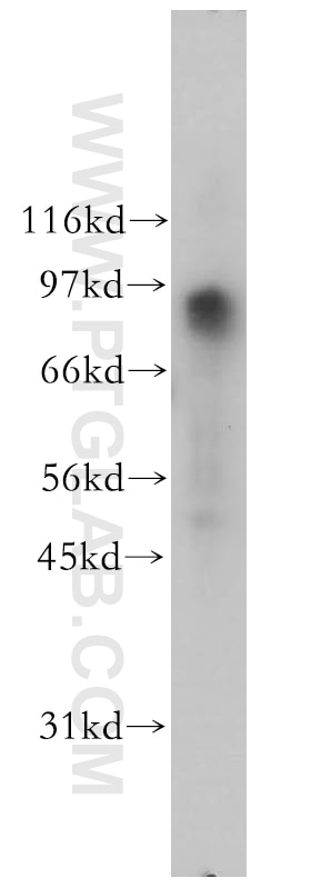 Western Blot (WB) analysis of HeLa cells using FXR2 Polyclonal antibody (12552-1-AP)