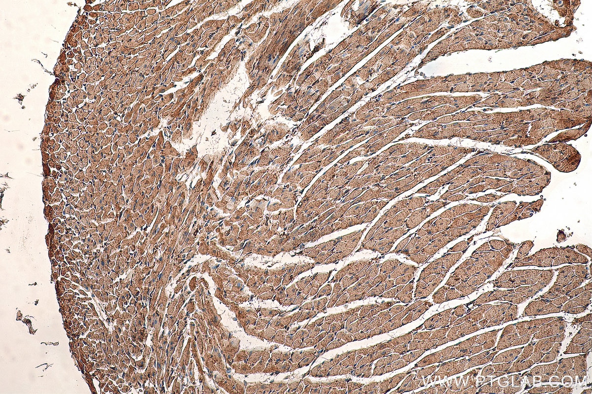 Immunohistochemistry (IHC) staining of mouse heart tissue using Phospholemman/FXYD1 Polyclonal antibody (13721-1-AP)