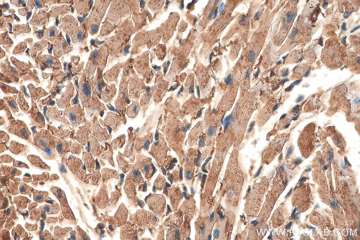 Immunohistochemistry (IHC) staining of mouse heart tissue using Phospholemman/FXYD1 Polyclonal antibody (13721-1-AP)