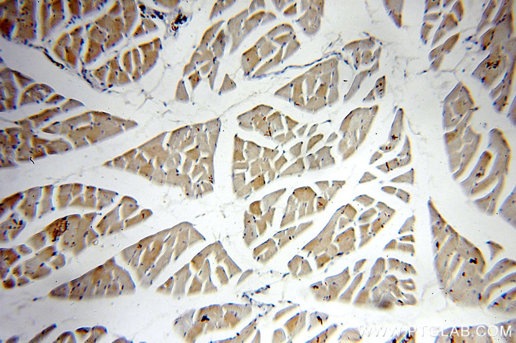 Immunohistochemistry (IHC) staining of human skeletal muscle tissue using Phospholemman/FXYD1 Polyclonal antibody (13721-1-AP)