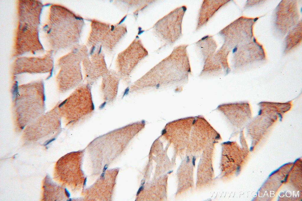 Immunohistochemistry (IHC) staining of human skeletal muscle tissue using Phospholemman/FXYD1 Polyclonal antibody (13721-1-AP)