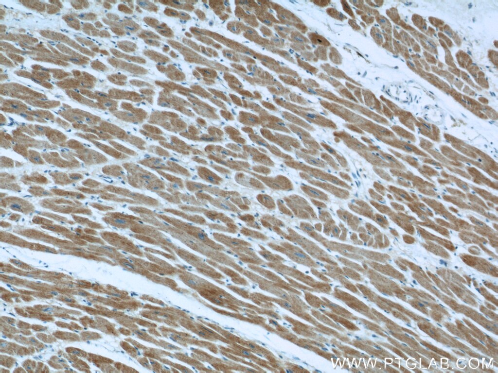 Immunohistochemistry (IHC) staining of human heart tissue using Phospholemman/FXYD1 Polyclonal antibody (13721-1-AP)