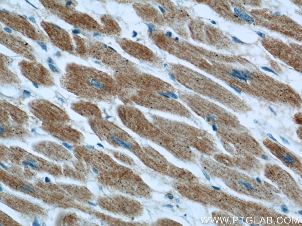 IHC staining of human heart using 13721-1-AP