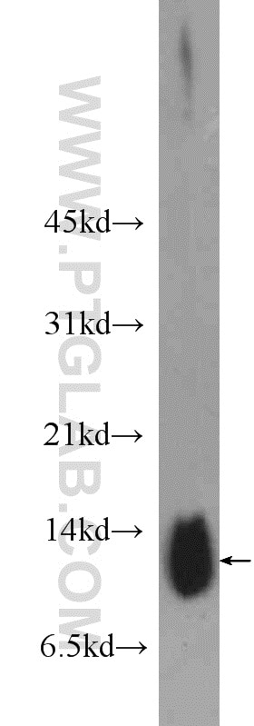 Western Blot (WB) analysis of rat skeletal muscle tissue using Phospholemman/FXYD1 Polyclonal antibody (13721-1-AP)