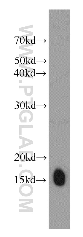 WB analysis of mouse skeletal muscle using 13721-1-AP