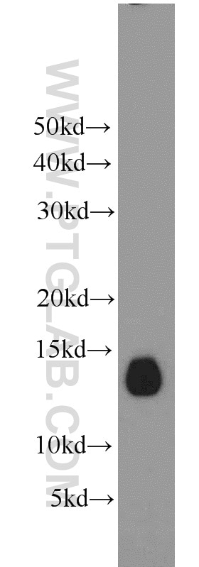 WB analysis of human skeletal muscle using 13721-1-AP