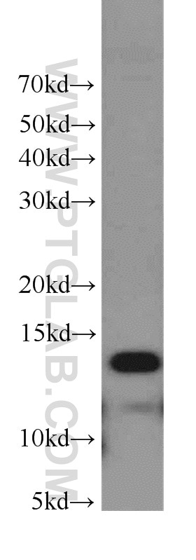 Western Blot (WB) analysis of mouse kidney tissue using Phospholemman/FXYD1 Polyclonal antibody (13721-1-AP)