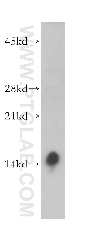 Western Blot (WB) analysis of human brain tissue using Phospholemman/FXYD1 Polyclonal antibody (13721-1-AP)