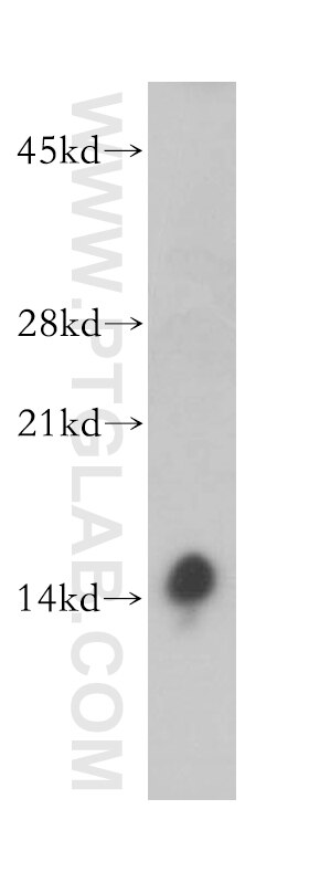 WB analysis of human brain using 13721-1-AP