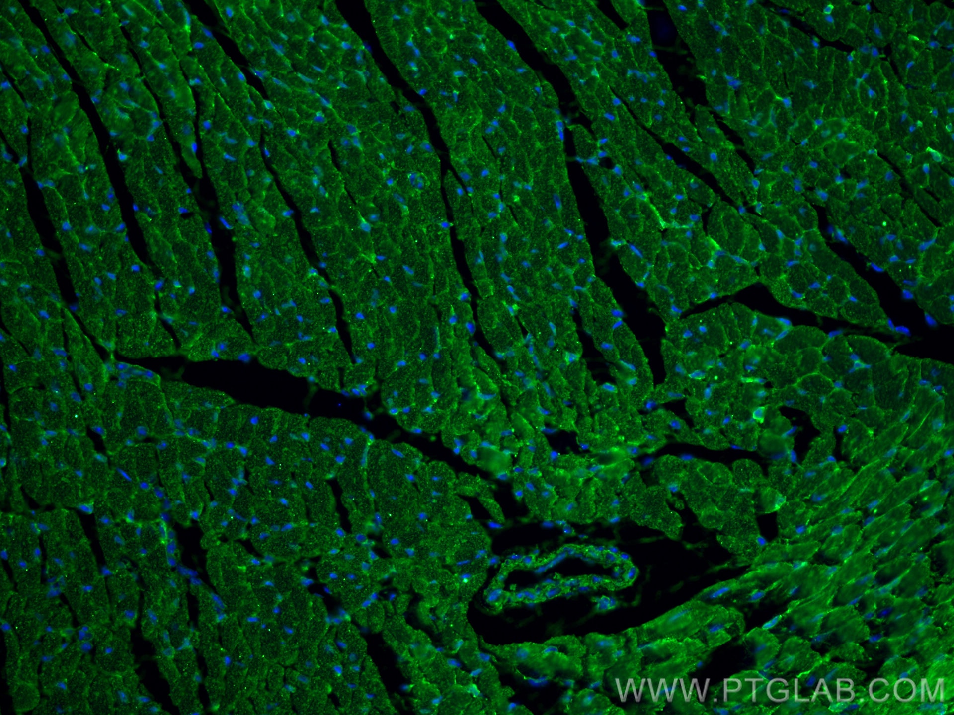 Immunofluorescence (IF) / fluorescent staining of mouse heart tissue using FXYD1 Monoclonal antibody (67150-1-Ig)