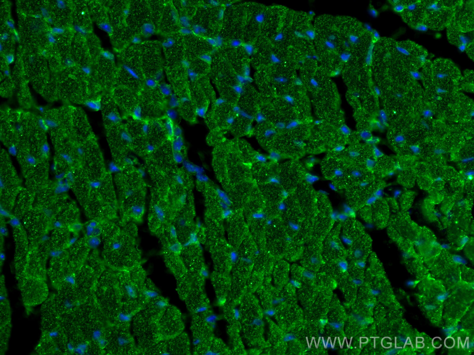 Immunofluorescence (IF) / fluorescent staining of mouse heart tissue using FXYD1 Monoclonal antibody (67150-1-Ig)