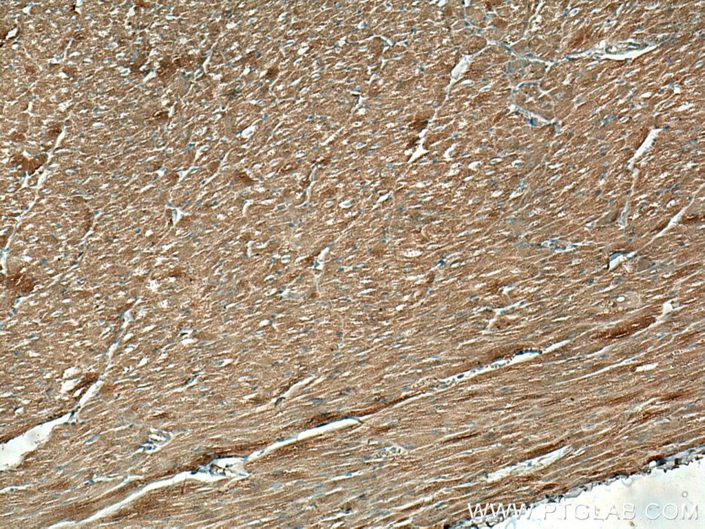Immunohistochemistry (IHC) staining of human heart tissue using FXYD1 Monoclonal antibody (67150-1-Ig)