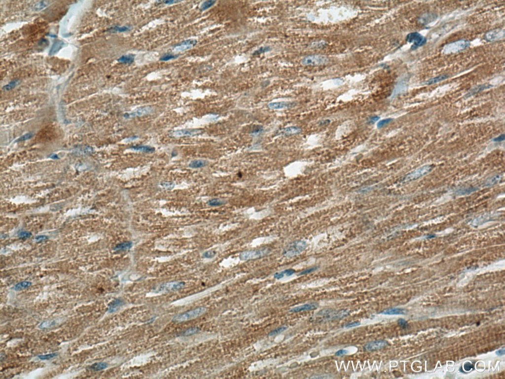Immunohistochemistry (IHC) staining of human heart tissue using FXYD1 Monoclonal antibody (67150-1-Ig)