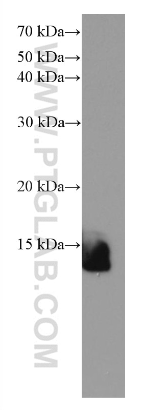 Western Blot (WB) analysis of human skeletal muscle tissue using FXYD1 Monoclonal antibody (67150-1-Ig)