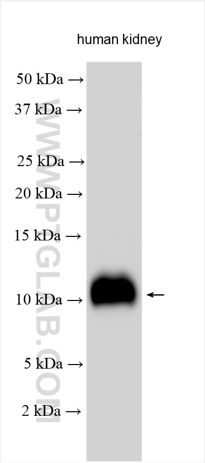 Western Blot (WB) analysis of various lysates using FXYD2 Polyclonal antibody (11198-1-AP)