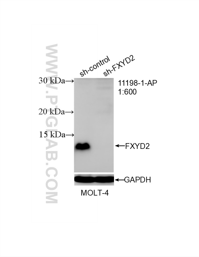 Western Blot (WB) analysis of MOLT-4 cells using FXYD2 Polyclonal antibody (11198-1-AP)