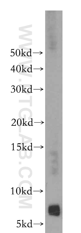 Western Blot (WB) analysis of HEK-293 cells using FXYD2 Polyclonal antibody (11198-1-AP)