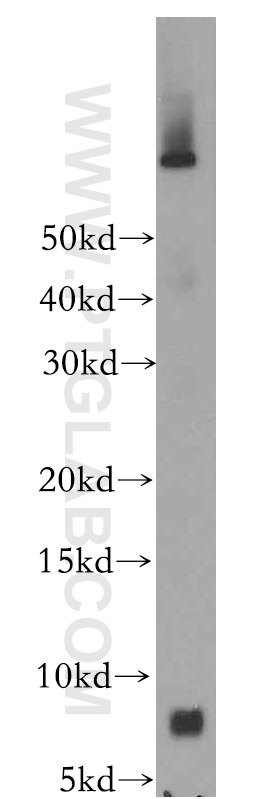 Western Blot (WB) analysis of mouse skeletal muscle tissue using FXYD2 Polyclonal antibody (11198-1-AP)