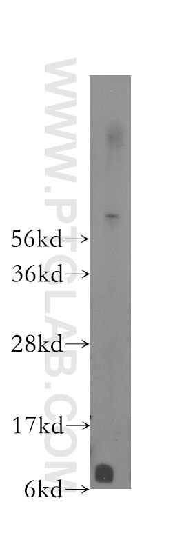 Western Blot (WB) analysis of human liver tissue using FXYD2 Polyclonal antibody (11198-1-AP)