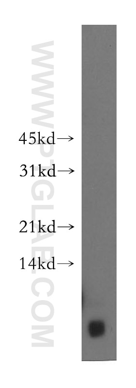 Western Blot (WB) analysis of human skeletal muscle tissue using FXYD2 Polyclonal antibody (11198-1-AP)