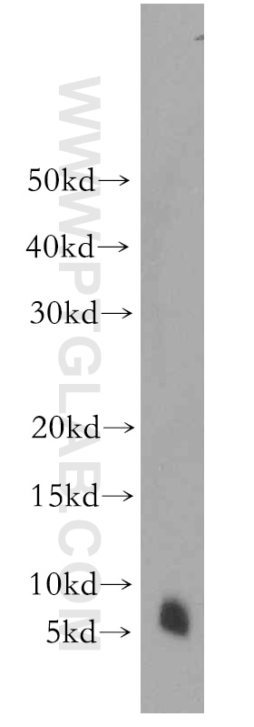 Western Blot (WB) analysis of human kidney tissue using FXYD2 Polyclonal antibody (11198-1-AP)