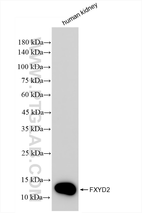 Western Blot (WB) analysis of human kidney tissue using FXYD2 Recombinant antibody (83860-1-RR)
