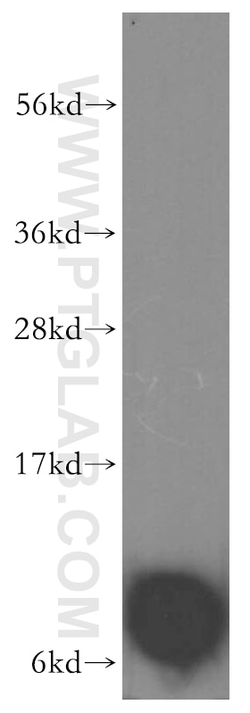 Western Blot (WB) analysis of A375 cells using FXYD3 Polyclonal antibody (15853-1-AP)