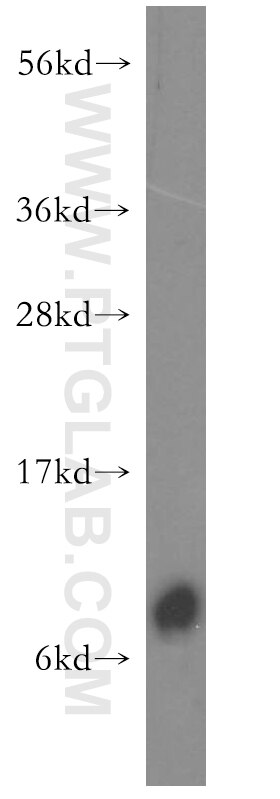 Western Blot (WB) analysis of SGC-7901 cells using FXYD3 Polyclonal antibody (15853-1-AP)