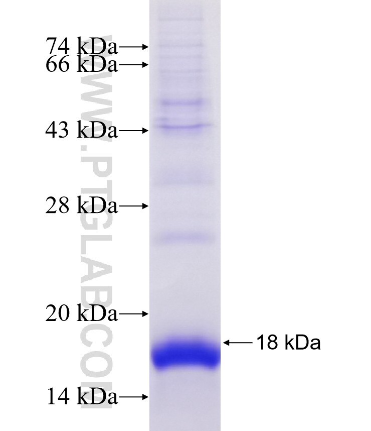 FXYD3 fusion protein Ag8688 SDS-PAGE FXYD3 fusion protein Ag8688 SDS-PAGE