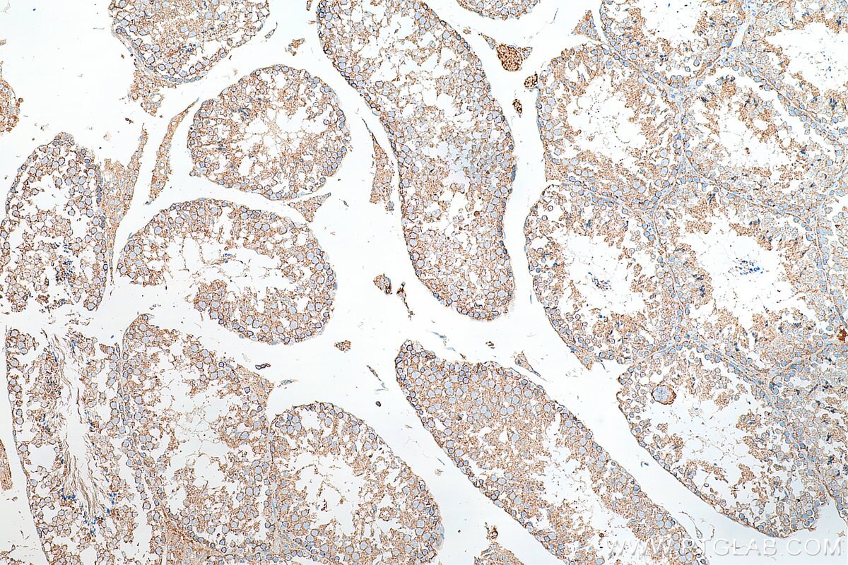 Immunohistochemistry (IHC) staining of mouse testis tissue using FXYD4 Polyclonal antibody (11966-1-AP)