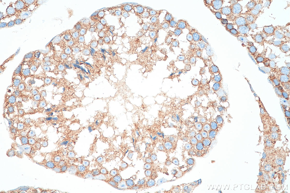 Immunohistochemistry (IHC) staining of mouse testis tissue using FXYD4 Polyclonal antibody (11966-1-AP)