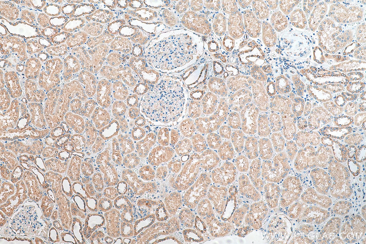 Immunohistochemistry (IHC) staining of human kidney tissue using FXYD4 Polyclonal antibody (11966-1-AP)