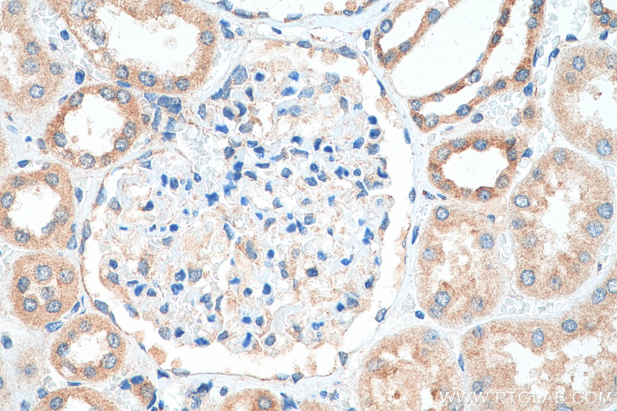 Immunohistochemistry (IHC) staining of human kidney tissue using FXYD4 Polyclonal antibody (11966-1-AP)