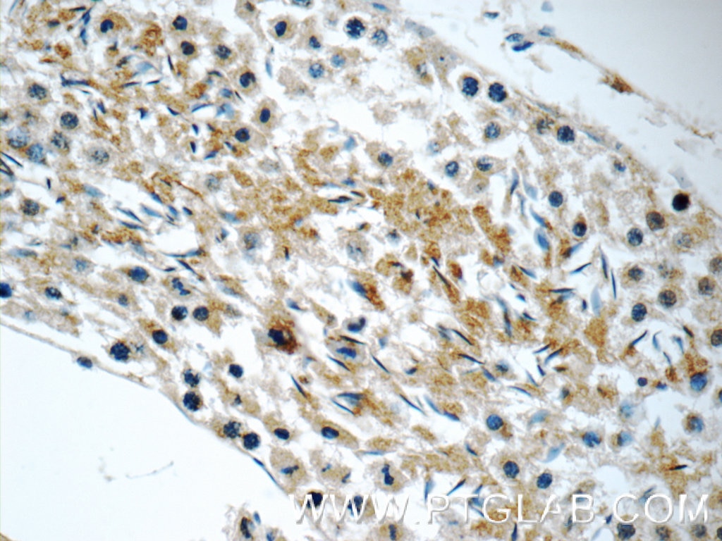 FXYD4 Polyclonal antibody