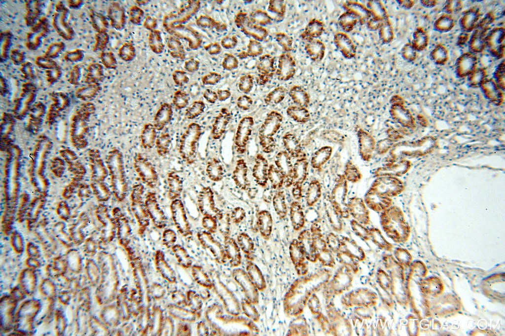 Immunohistochemistry (IHC) staining of human kidney tissue using Dysadherin Polyclonal antibody (12166-1-AP)