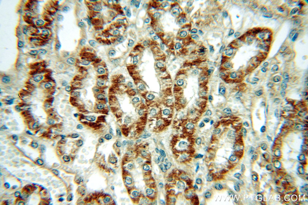 Immunohistochemistry (IHC) staining of human kidney tissue using Dysadherin Polyclonal antibody (12166-1-AP)